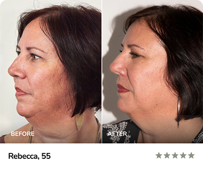 Results-Rebecca