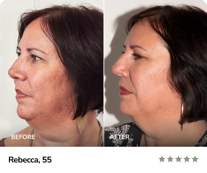 Results-Rebecca