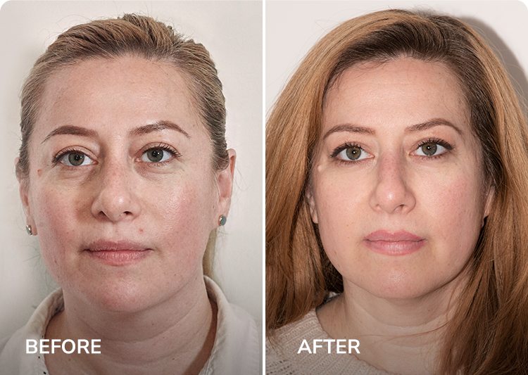 Rosa Results Rosa Results